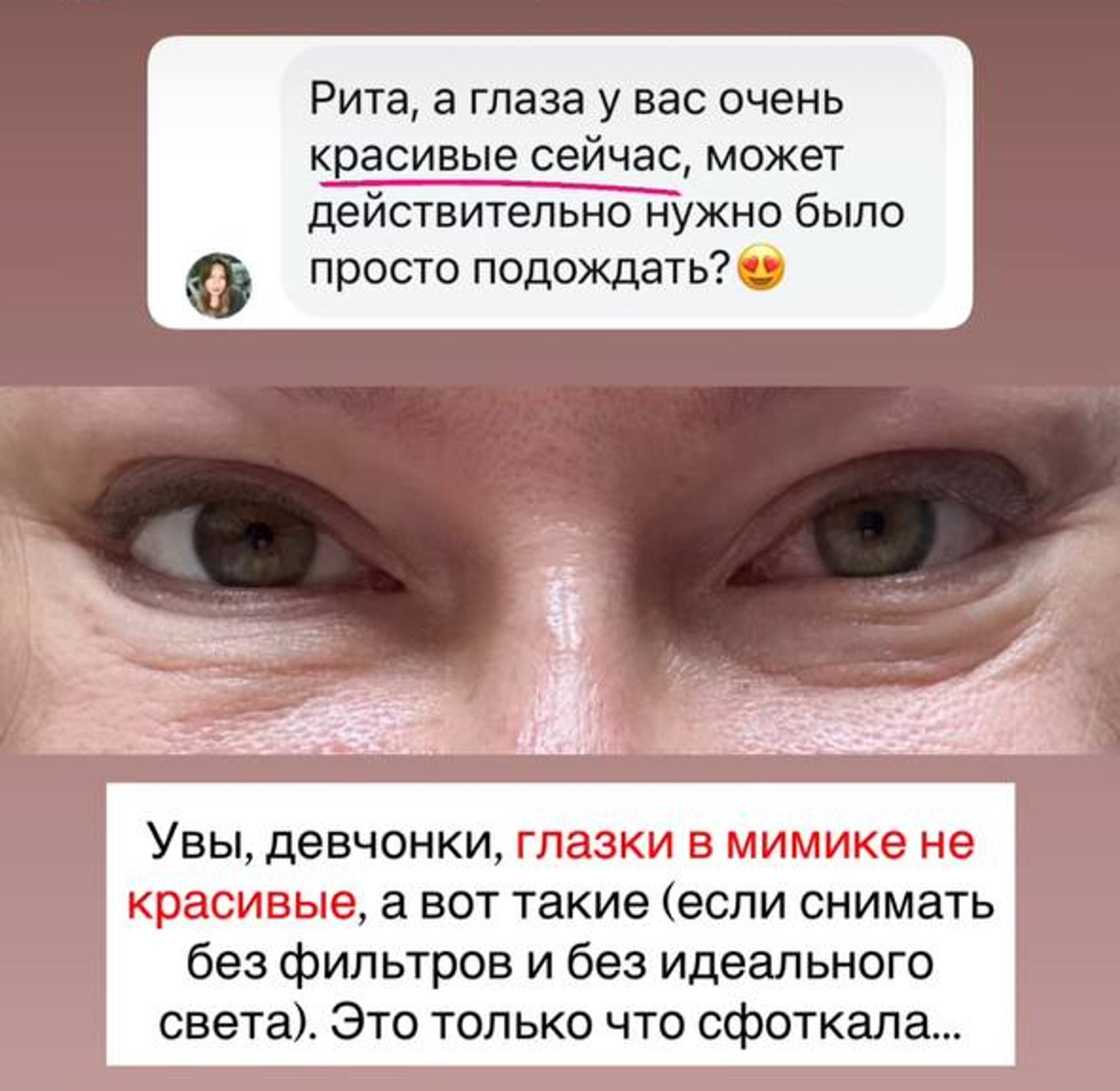 Результат пластической операции. Скриншот: Instagram (запрещён в РФ) @ritadakota
