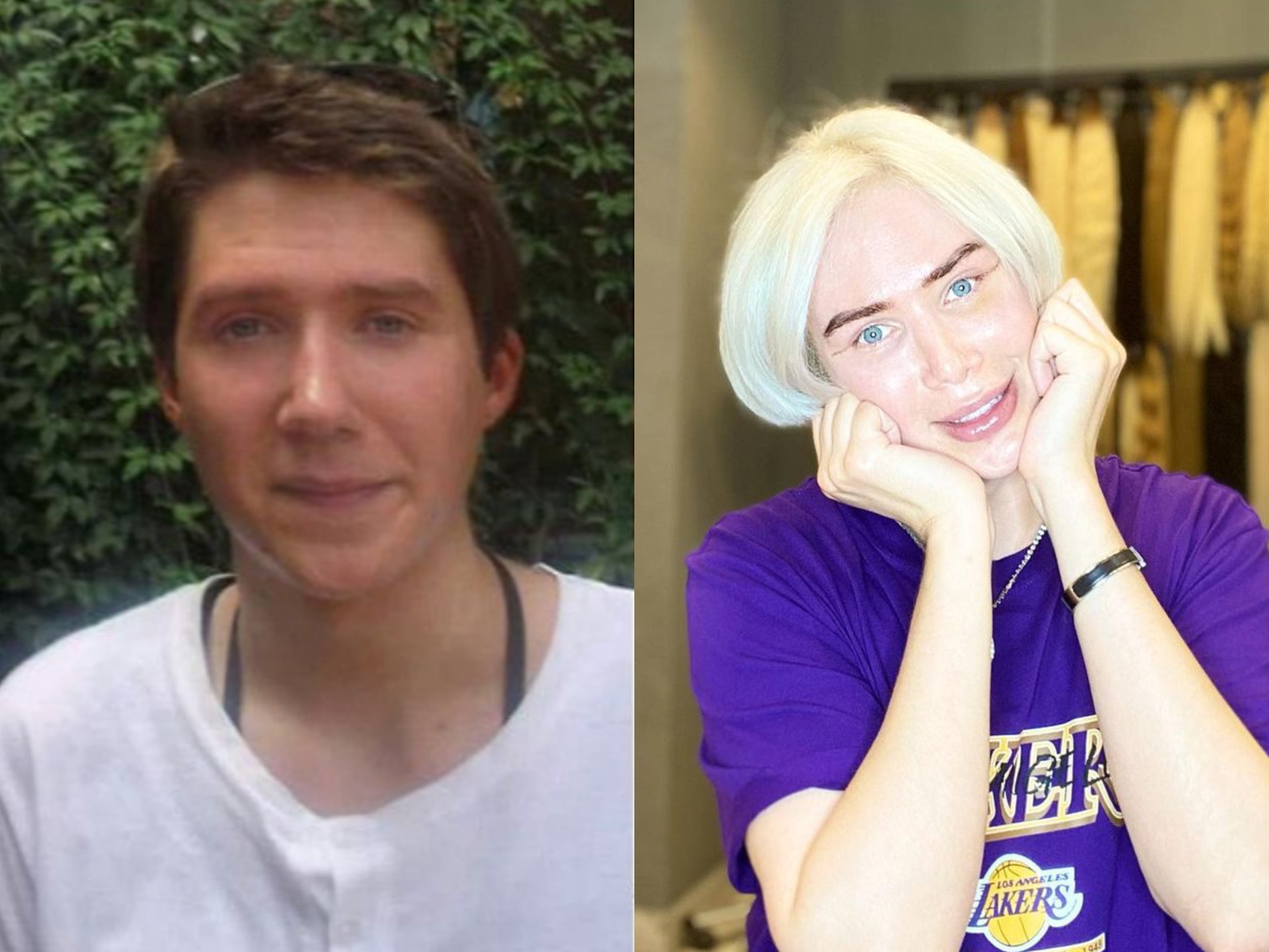 Оли Лондон до и после пластических операций. Фото: @londonoli