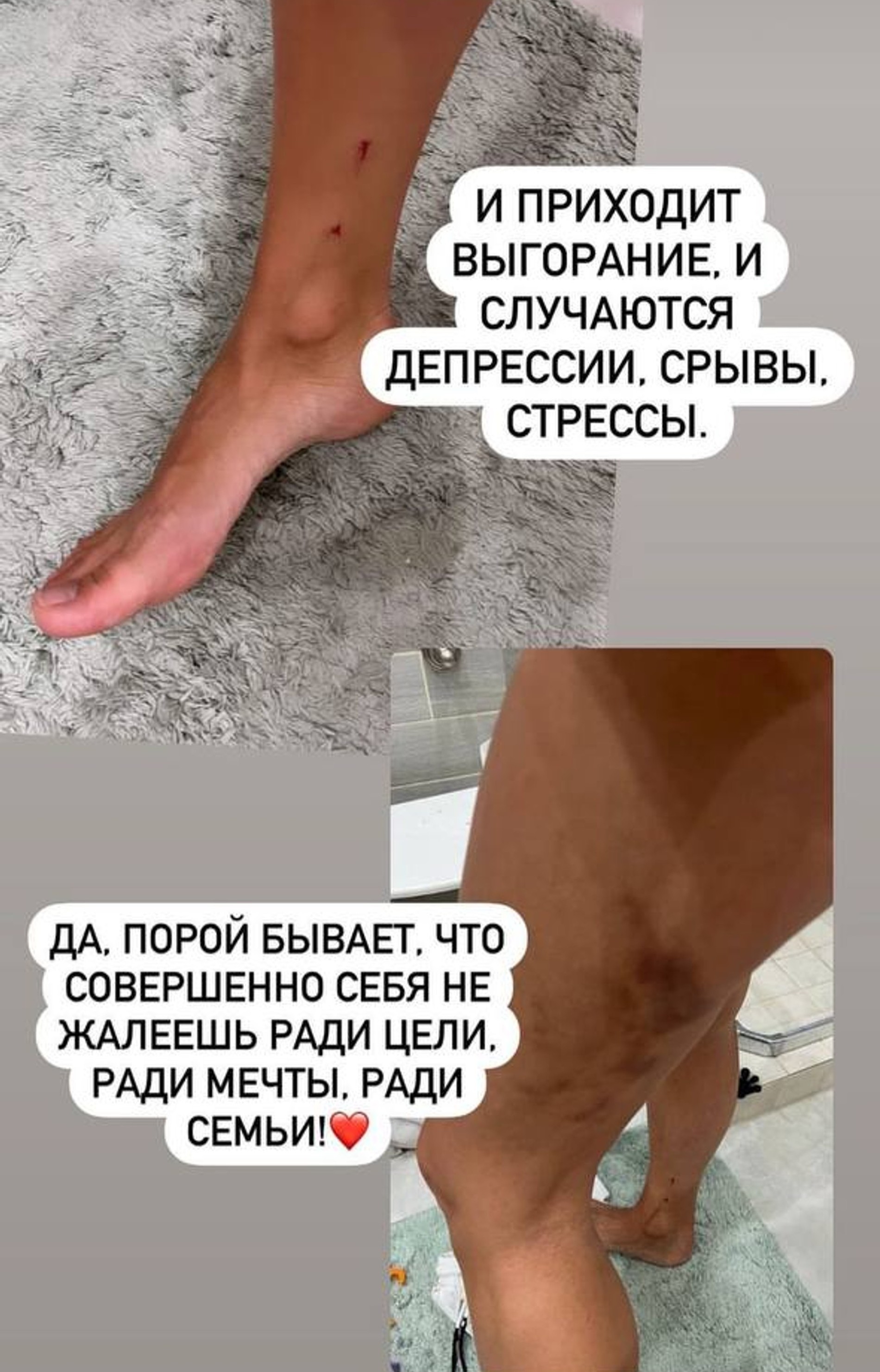 Регина Тодоренко
Фото: Инстаграм (запрещен в РФ)