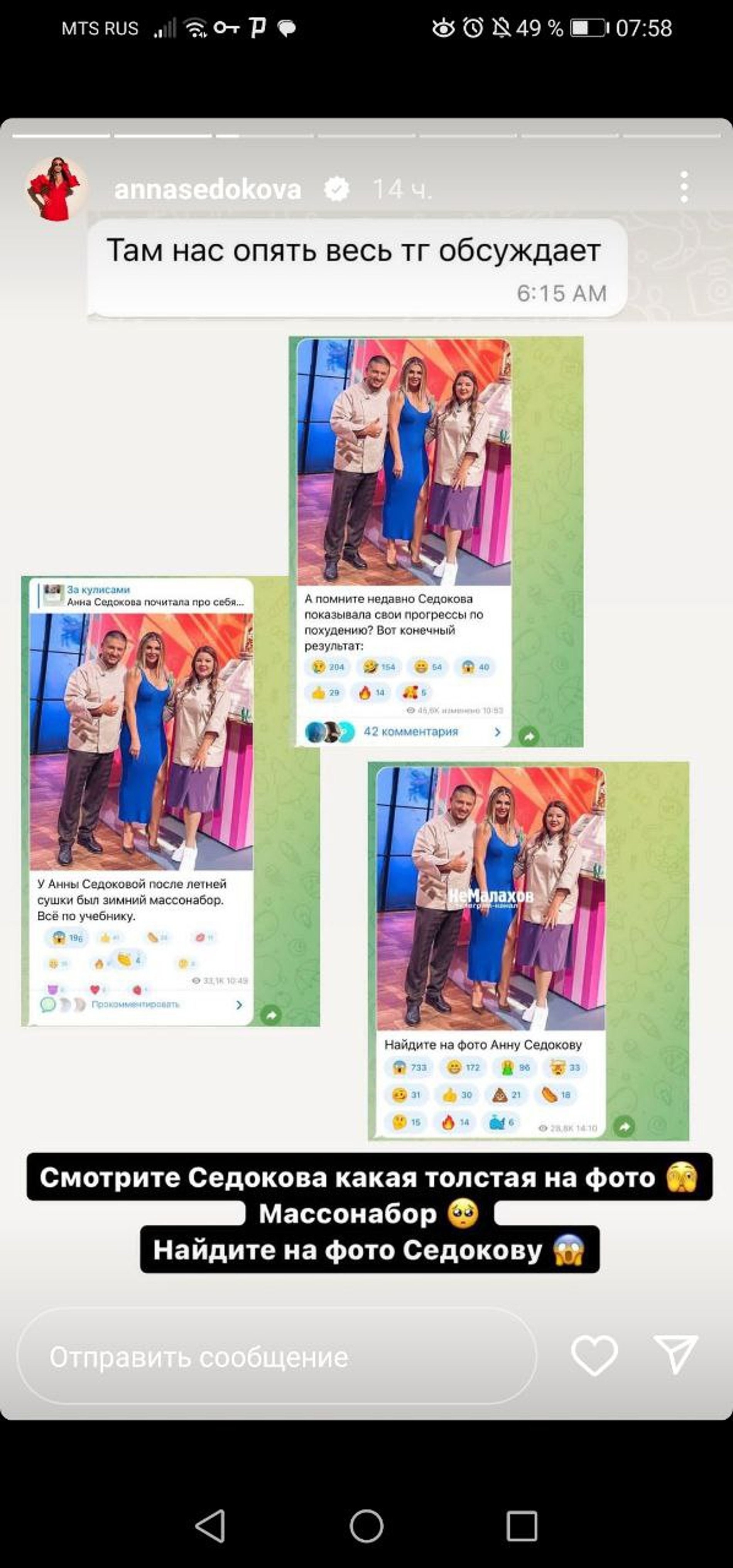 Фото: Инстаграм (запрещен в РФ) Анны Седоковой