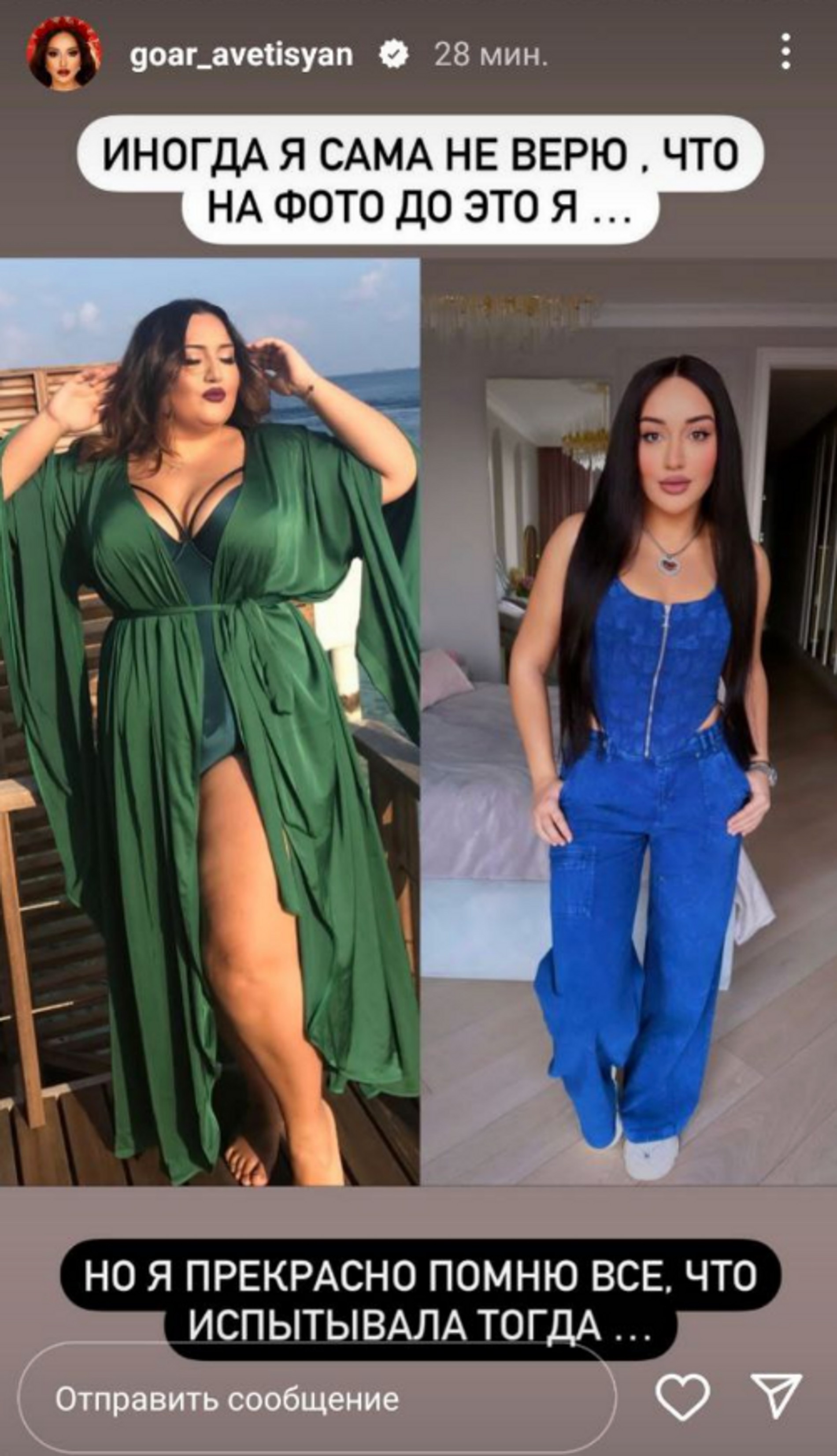 Гоар Аветисян до и после похудения
Фото: Инстаграм (запрещен в РФ) @goar_avetisyan