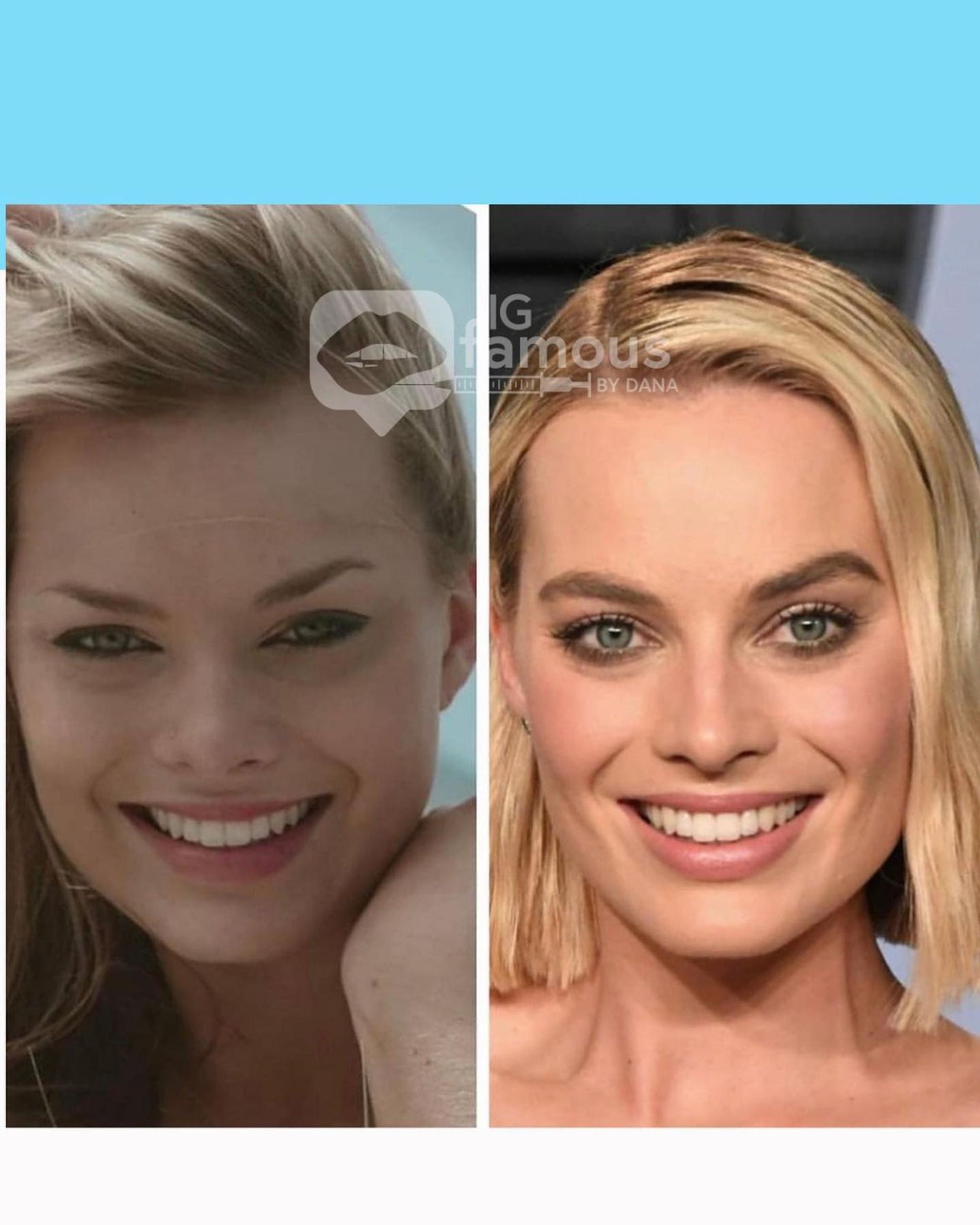 Марго Робби до и после изменений во внешности. Фото: Инстаграм* @igfamousbydana