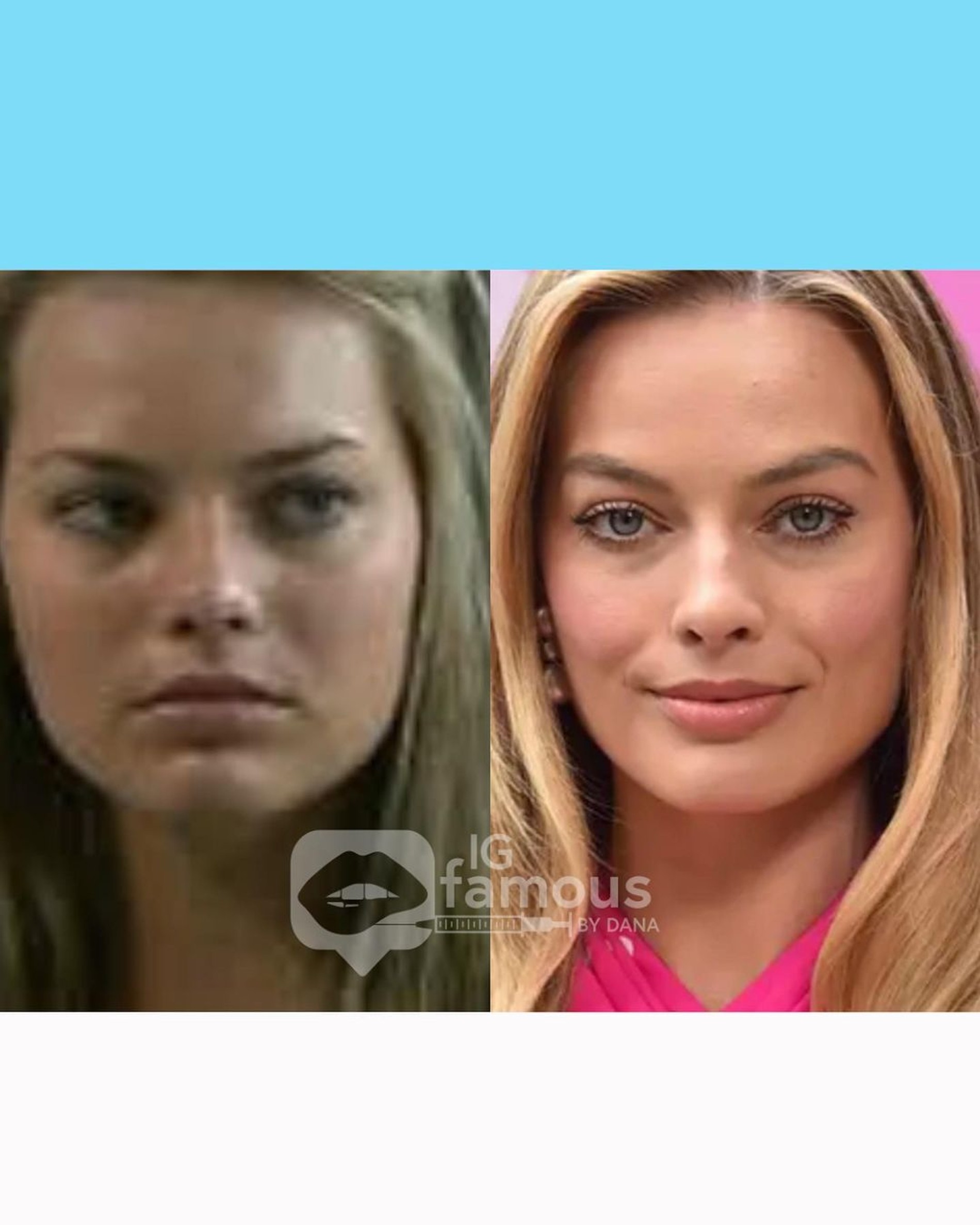 Марго Робби до и после изменений во внешности. Фото: Инстаграм* @igfamousbydana