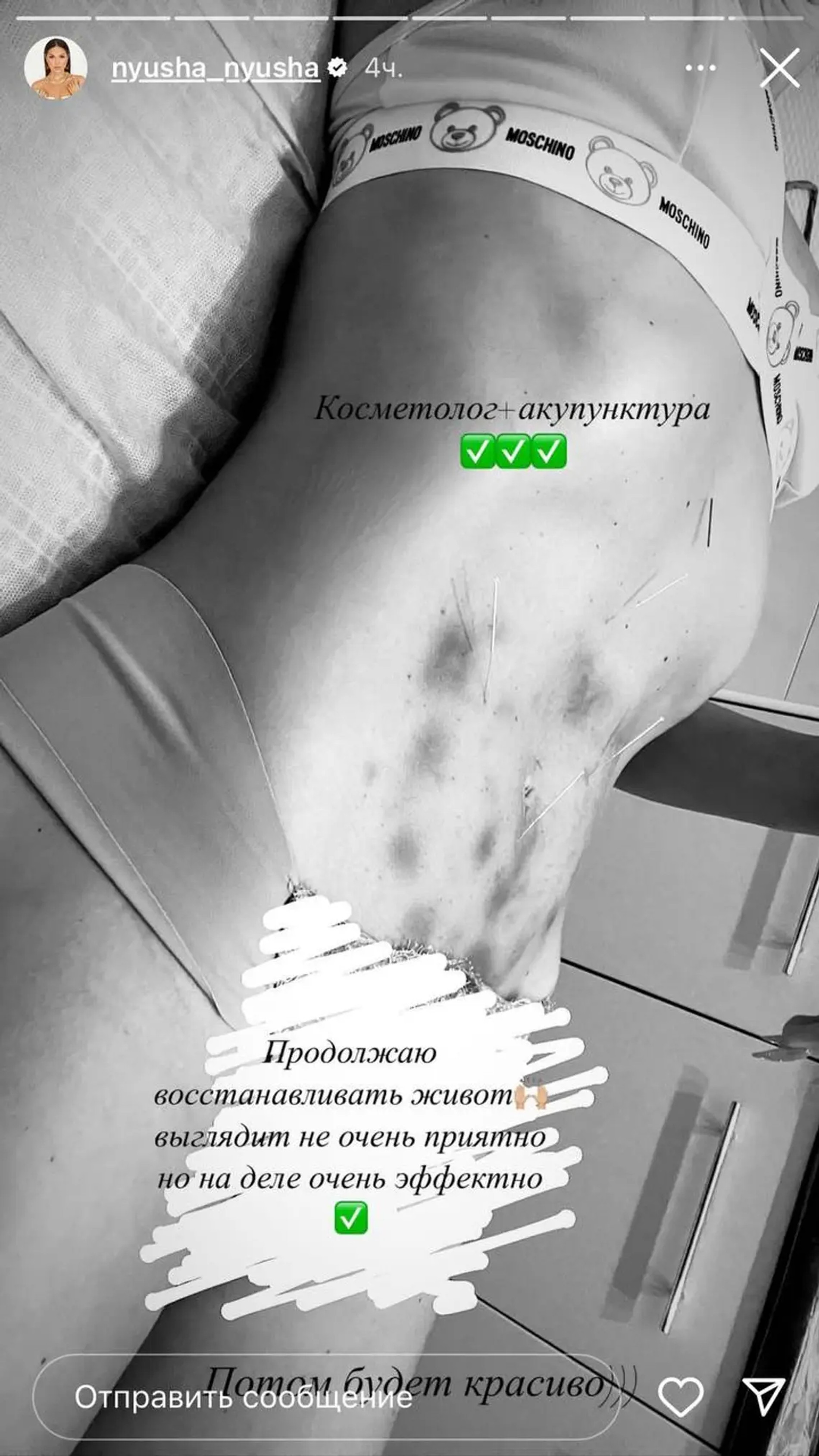 Фото: Инстаграм* @nyusha_nyusha