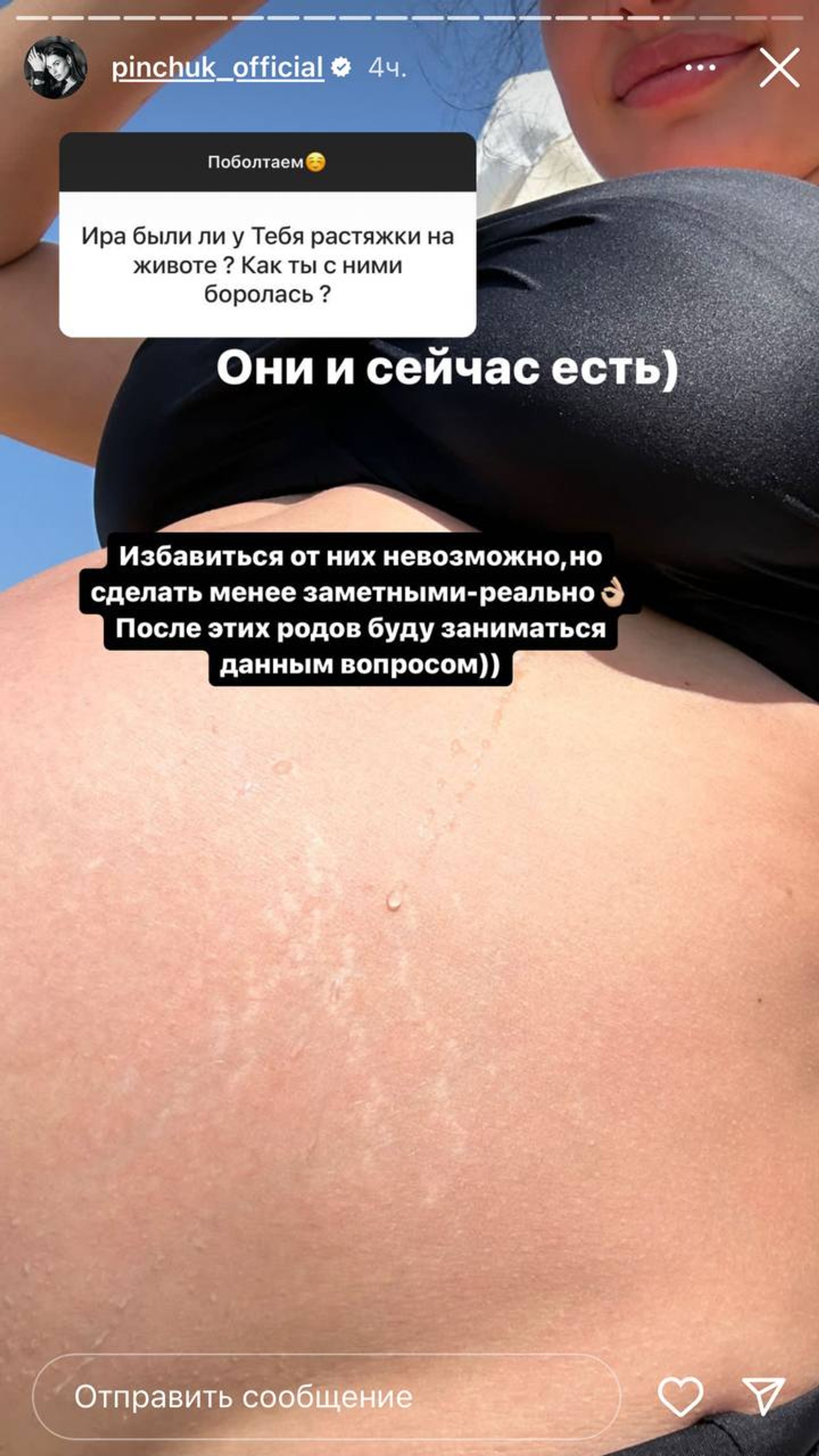 Фото: Инстаграм* @pinchuk_official