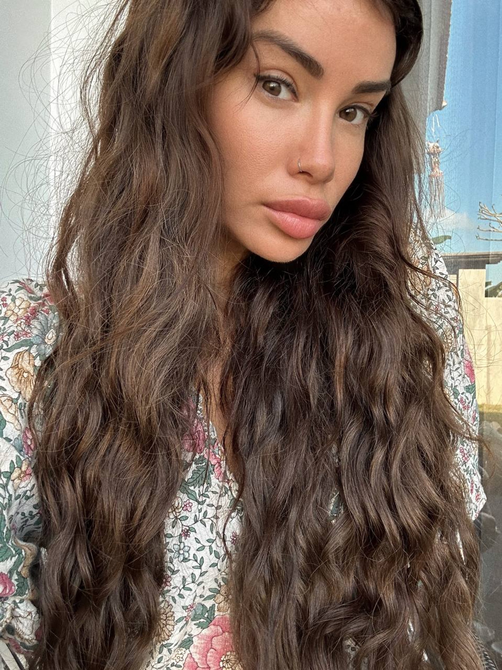 Айза-Лилуна Ай демонстрирует лицо после бьюти-процедуры. Фото: Telegram-канал Айзы-Лилуны Ай