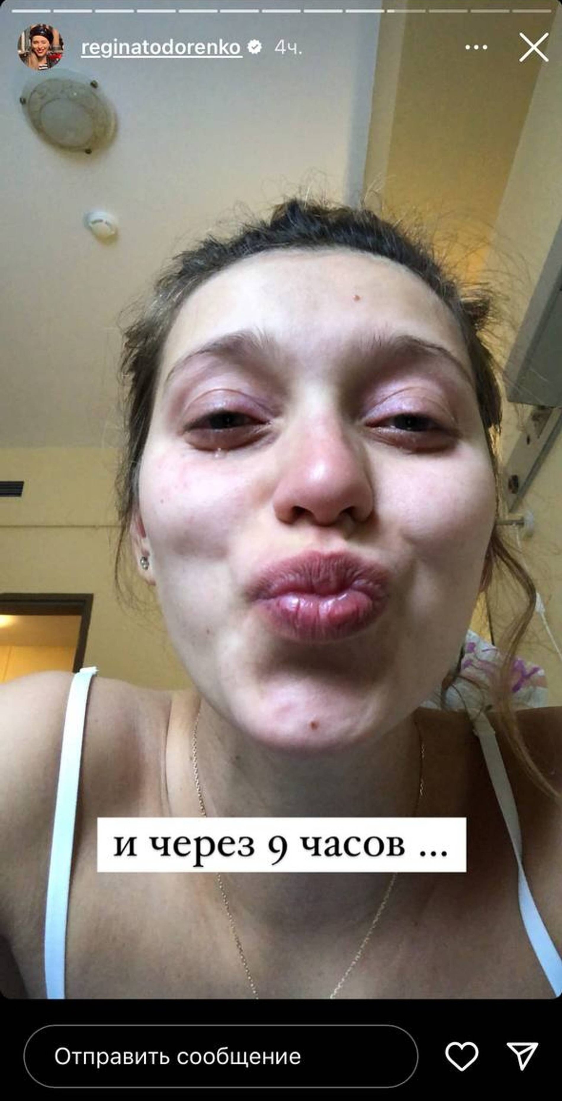 Регина Тодоренко. Фото: Инстаграм* @reginatodorenko