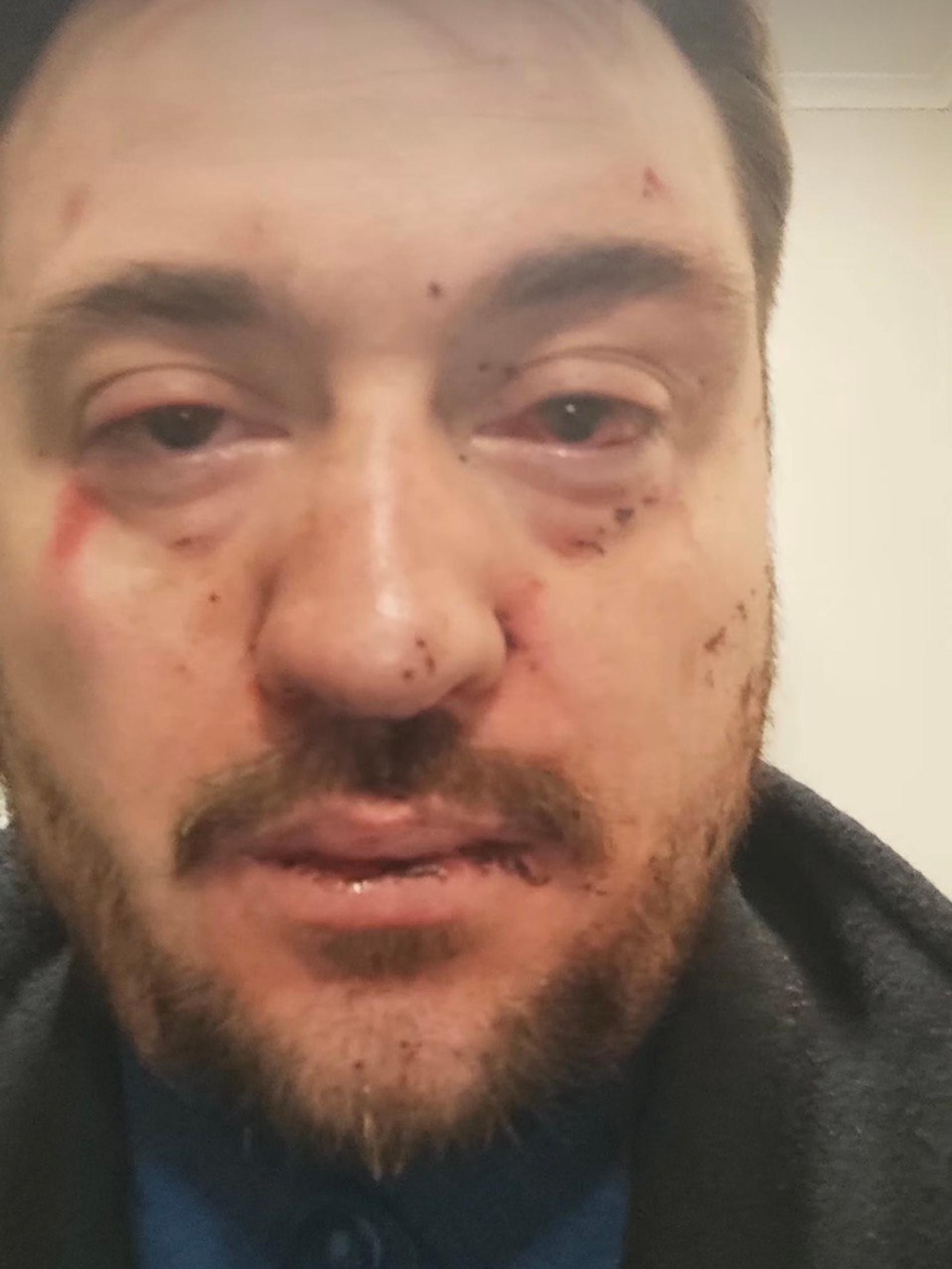 Звезда российских сериалов Руслан Алдонин сообщил об избиении. Фото: Инстаграм* @ruslan_aldonin1984