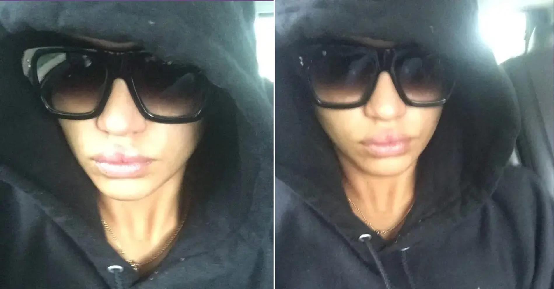 Кэсси Вентура после избиения P. Diddy. Фото: RadarOnline